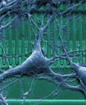 RatNeuronOnChip_color_smaller.jpg