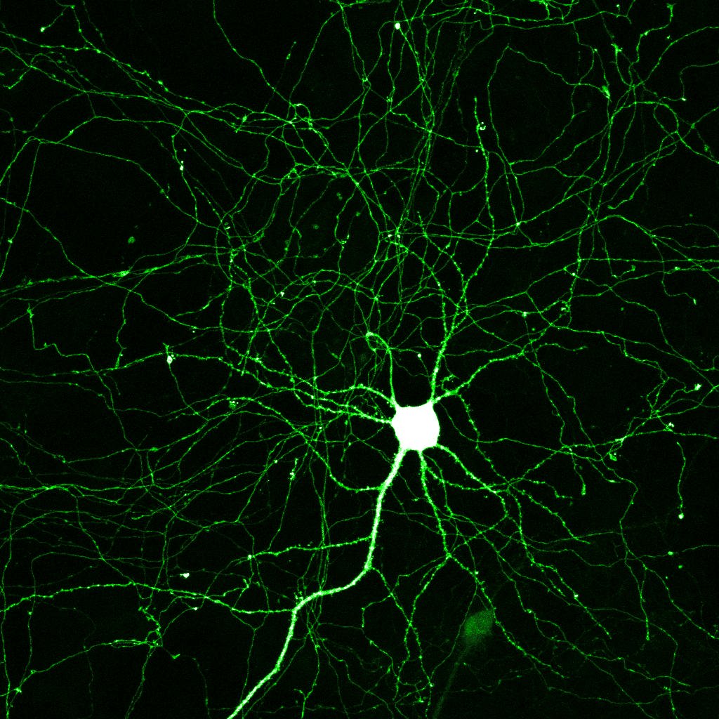 Pictures Of Neuron In Brain 4